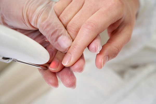 Лазерное лечение онихомикоза (грибковых поражений ногтей)